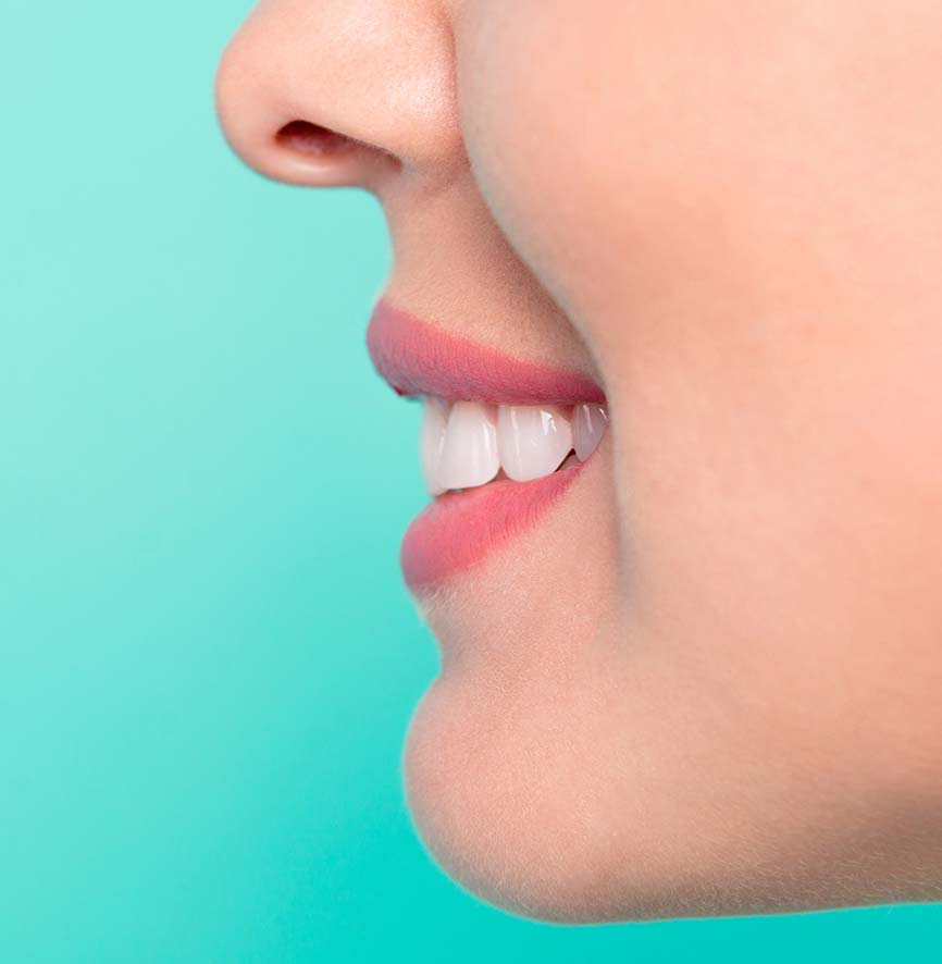 Previewing a smile transformation with iTero before Invisalign